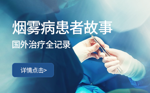 烟雾病治疗